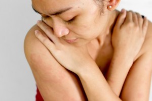 Woman hiding her infected body